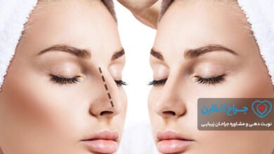 بهترین جراح بینی در تهران【سال 1402】+ هزینه و نمونه کار