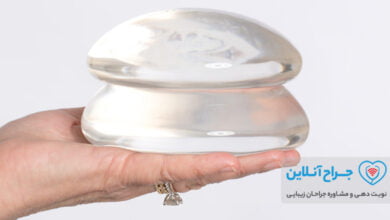 بهترین دکتر پروتز سینه در تهران+ هزینه و نمونه کار