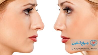 بهترین جراح بینی استخوانی در تهران + هزینه و نمونه کار