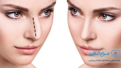 بهترین دکتر جراح بینی مدل نیمه فانتزی در تهران + هزینه و نمونه کار