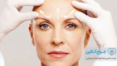 بهترین دکتر لیفت پیشانی در تهران + هزینه و نمونه کار