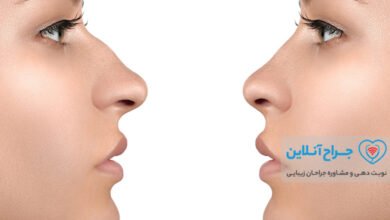 بهترین جراح بینی گوشتی در تهران + هزینه و نمونه کار