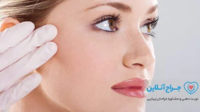 بهترین دکتر لیفت صورت در تهران【سال 1402】+ هزینه و نمونه کار ⭐