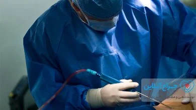 همه چیز در مورد لیپوساکشن (لیپوماتیک) + هزینه