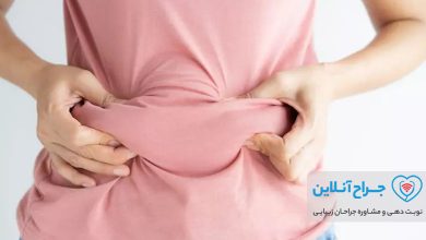 همه چیز در مورد ابدومینوپلاستی یا جراحی زیبایی شکم + هزینه