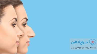 بهترین جراح بینی در مشهد + هزینه و نمونه کار