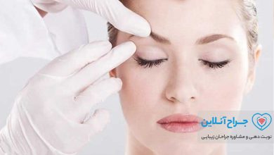 همه چیز در مورد جراحی زیبایی پلک ( بلفاروپلاستی ) + هزینه