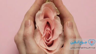 همه چیز در مورد لابیاپلاستی ( جراحی زیبایی واژن ) + هزینه