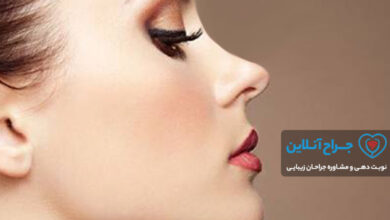 بهترین جراح بینی در نور