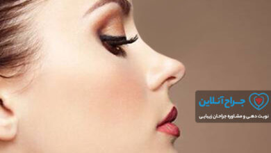 بهترین جراح بینی در آمل